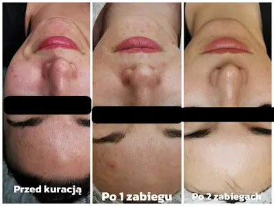 Be Glow by Beata Wierciszewska